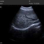 N50 Portable Ultrasound