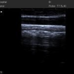 N50 Portable Ultrasound